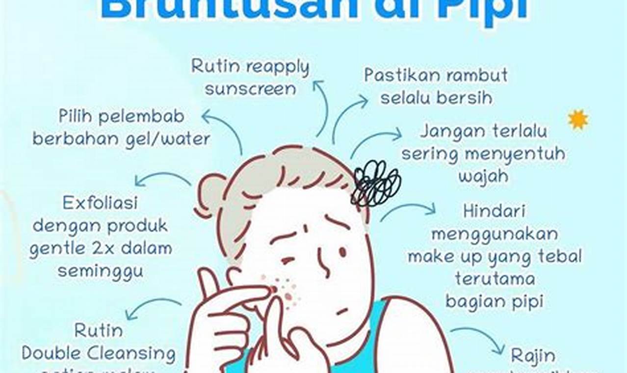 Cara Mengatasi Jerawat Di Pipi
